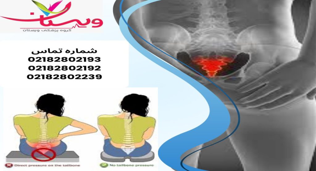 علائم آسیب دنبالچه علائم آسیب دنبالچه