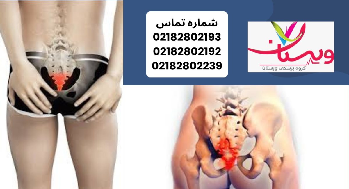 جا انداختن دنبالچه