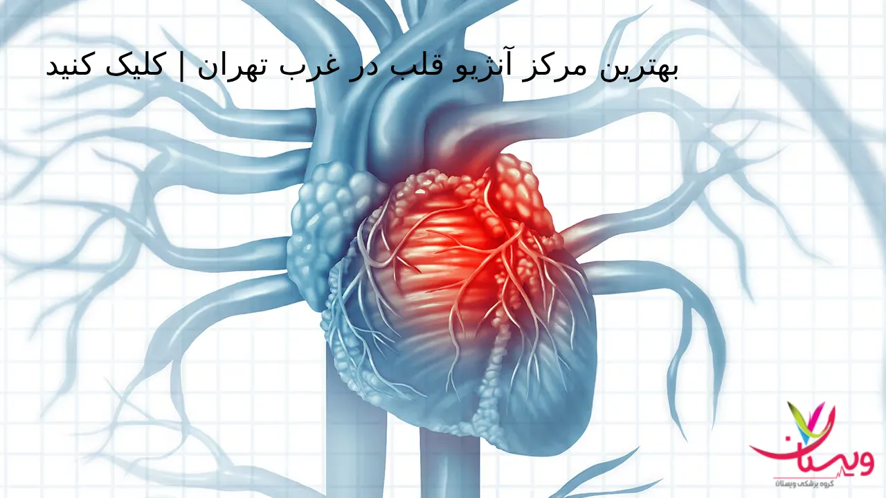 بهترین مرکز آنژیو قلب در غرب تهران