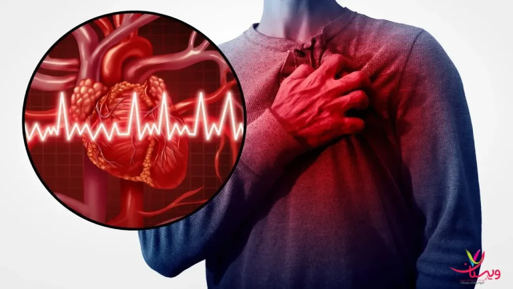 حمله قلبی تفاوت سکته قلبی و حمله قلبی از نظر علائم اولیه