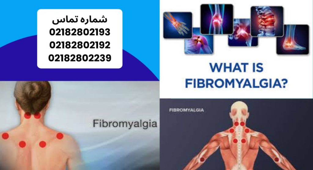فیبرومیالژیا چیست؟