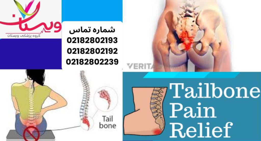 دنبالچه چیست دنبالچه چیست
