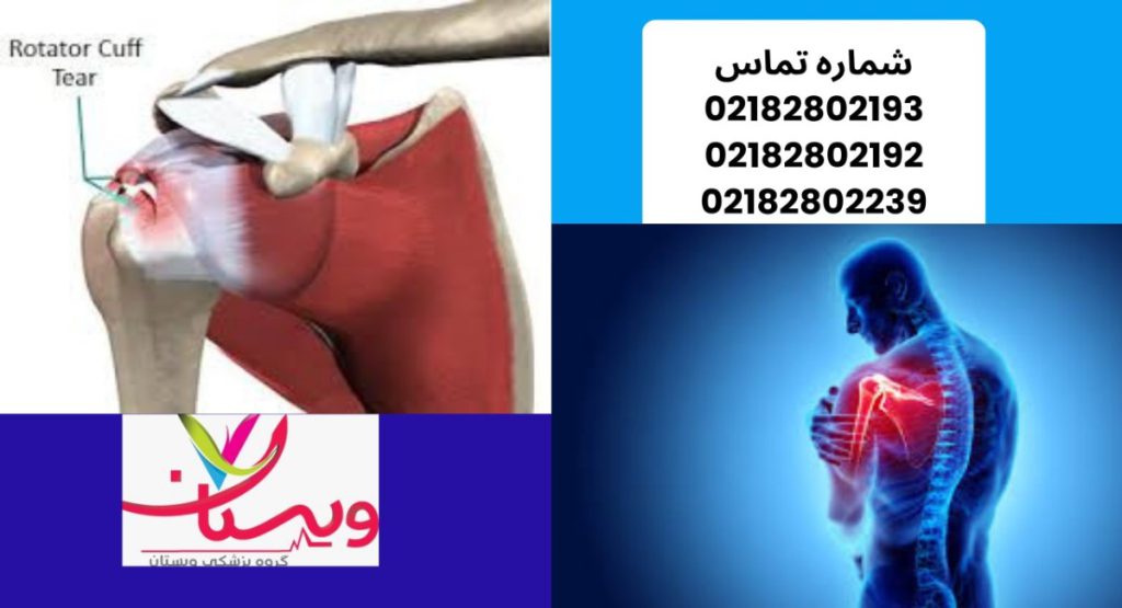 روتاتور کاف چیست؟ روتاتور کاف چیست؟