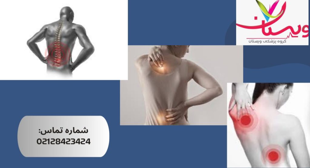اسپاسم عضلات پشت کمر