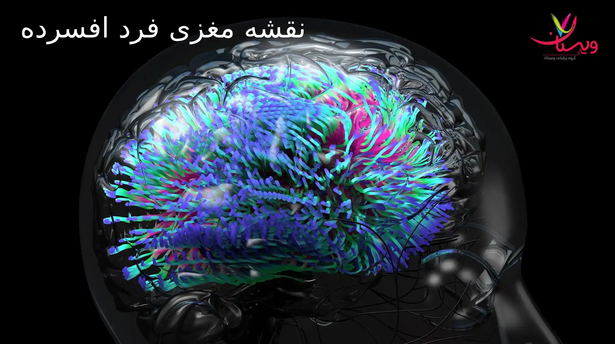 نقشه مغزی فرد افسرده و هر چیزی که باید بدانید!