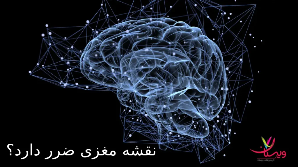 نقشه مغزی ضرر دارد؟ 14 مورد که باید بدانید