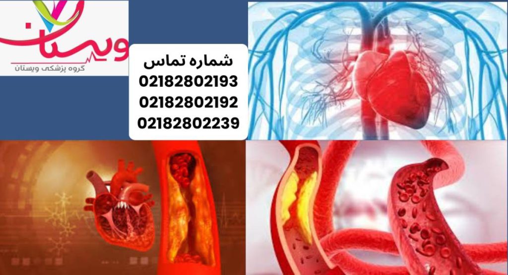 رسوب کلسیم در قلب و آمادهسازی قبل از سیتی آنژیو رسوب کلسیم در قلب و آمادهسازی قبل از سیتی آنژیو