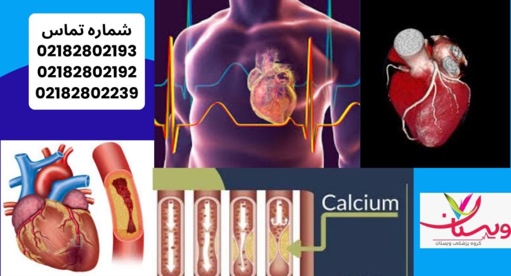رسوب کلسیم در قلب باعث کلسیفیکاسیون عروق کرونر رسوب کلسیم در قلب باعث کلسیفیکاسیون عروق کرونر