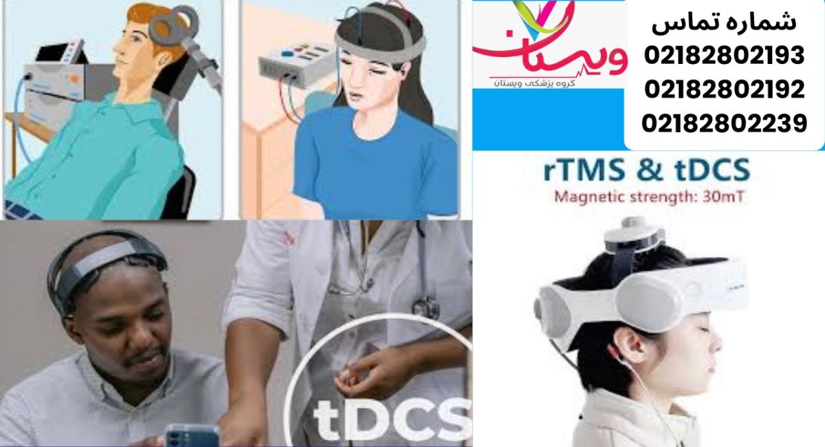تفاوت rTMS و tDCS