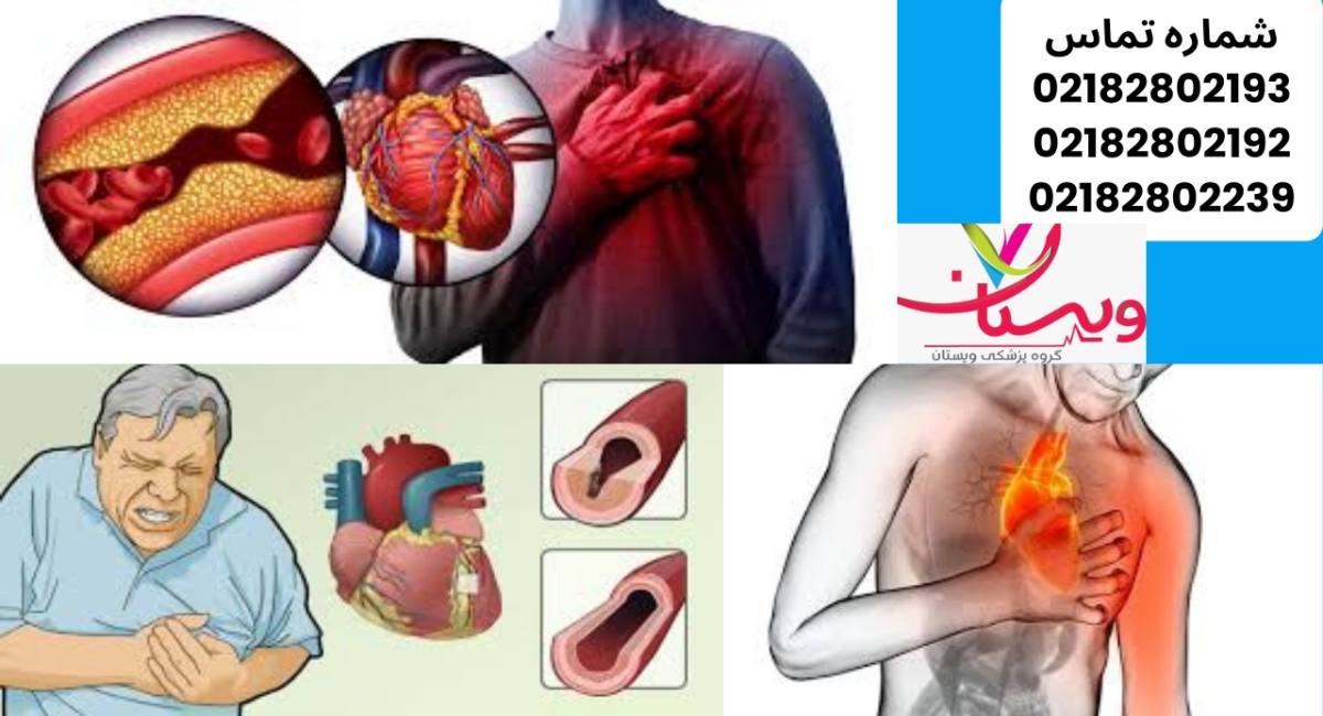 آیا آنژین قلبی خطرناک است؟ بررسی کامل + مقایسه، علل، درمان 1404