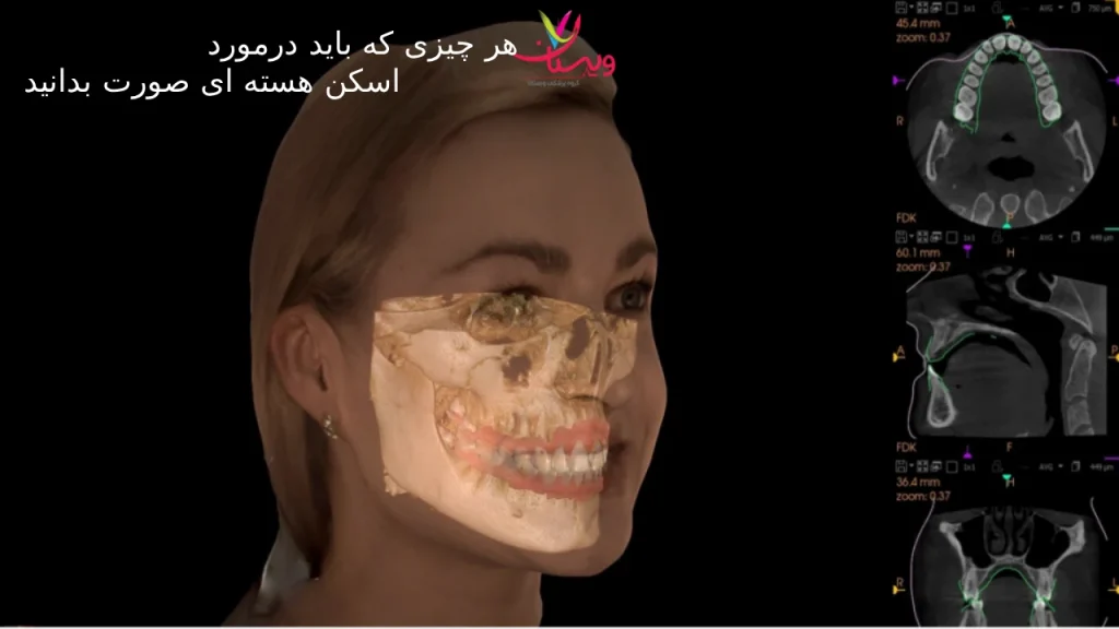 اسکن هستهای صورت + 10 نکته مهم که باید بدانید