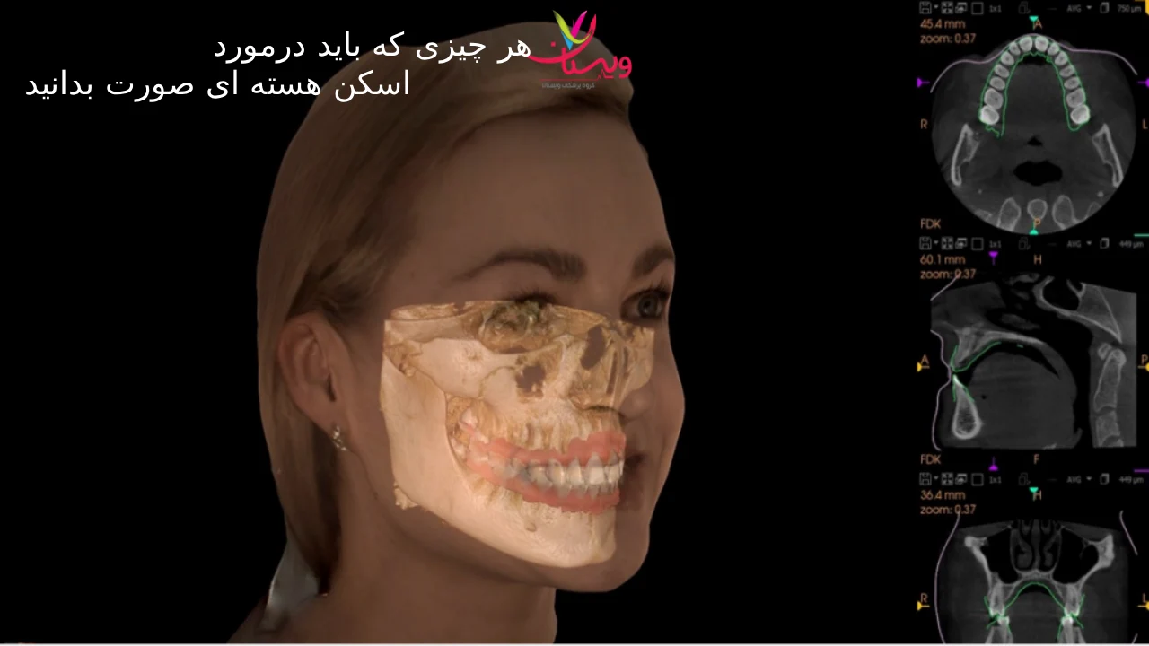 اسکن هسته‌ای صورت + 10 نکته مهم که باید بدانید