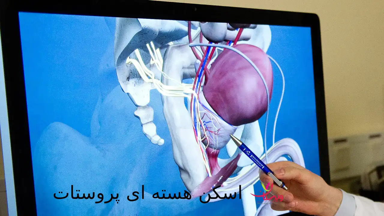 اسکن هسته‌ای پروستات| دقیق ترین اطلاعات درمورد این روش