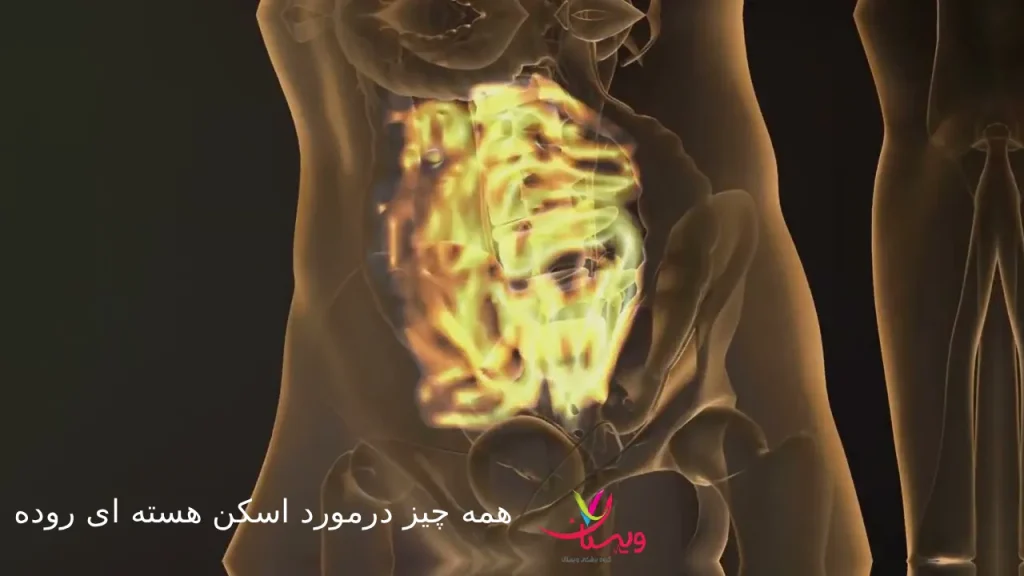 اسکن هستهای روده؛ همه چیز درباره کاربردها، نحوه انجام و آمادگی