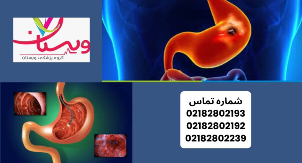 علائم خونریزی معده علائم خون ریزی معده