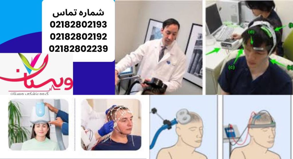 rTMS و tDCS چیستند؟ تفاوت tdcs و rtms چیستند؟