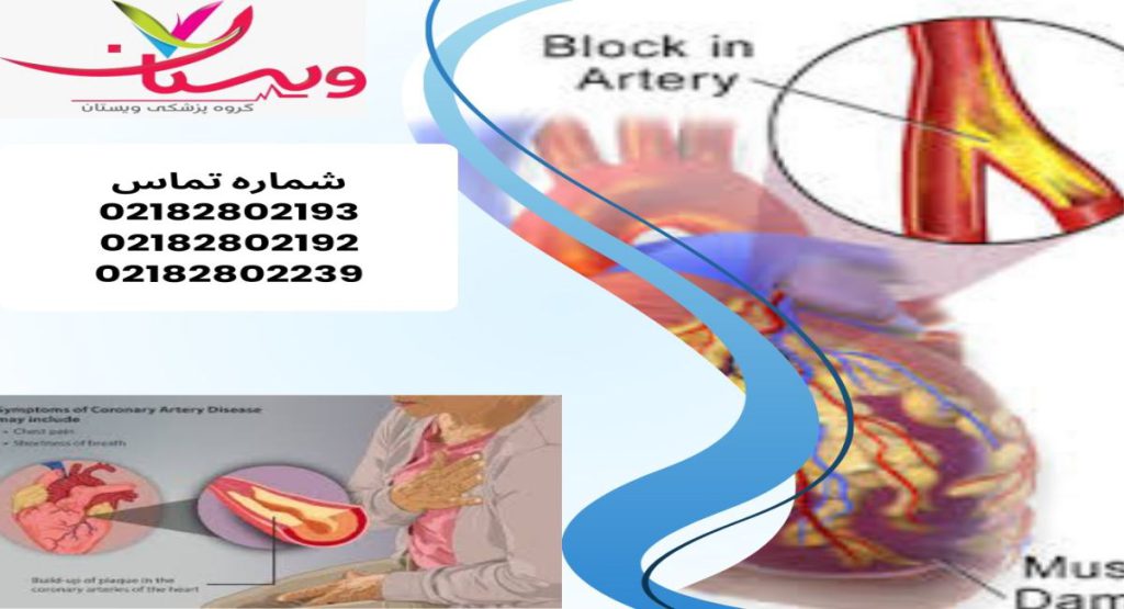 چه چیزی باعث رسوب کلسیم در قلب میشود؟ چه چیزی باعث رسوب کلسیم در قلب میشود؟
