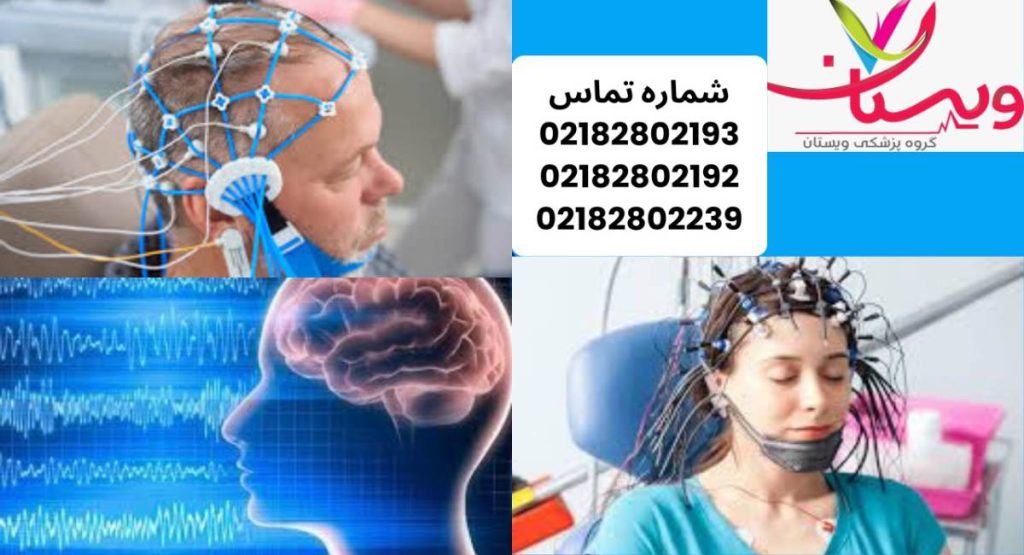 نوار مغز التیام چیست نوار مغز ال تی ام چیست