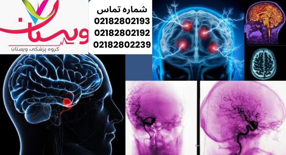 آنژیوگرافی مغز چیست؟