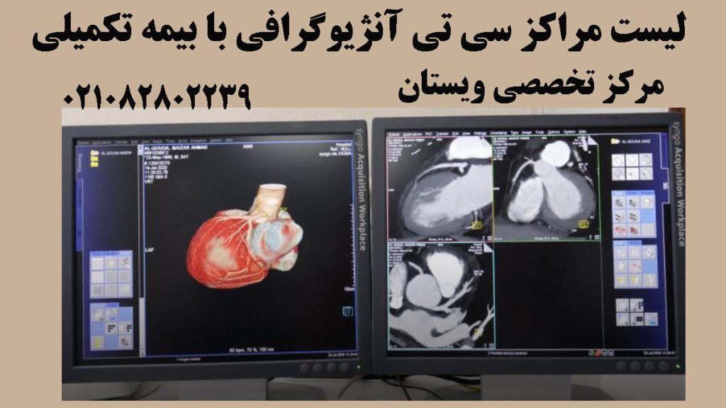 سی تی آنژیو قلب با بیمه تکمیلی