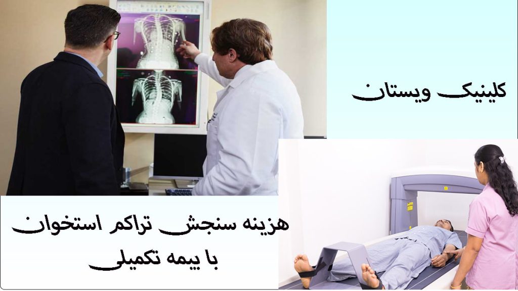 هزینه تراکم استخوان با بیمه تکمیلی اتیه سازان